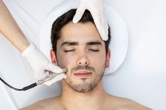 limpieza facial microdermoabrasion hombres medellin